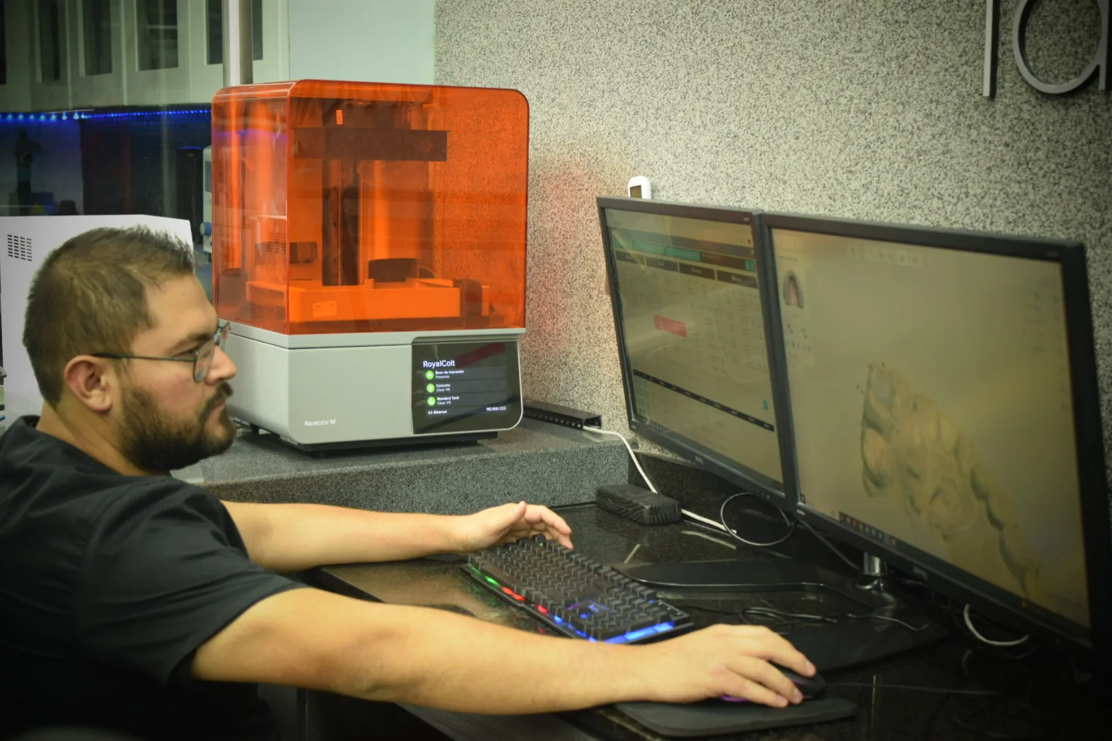 Diseño digital e impresión 3D en el laboratorio propio